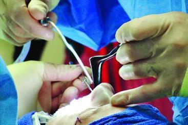 رتبه اول ایرانی ها در جراحی بینی