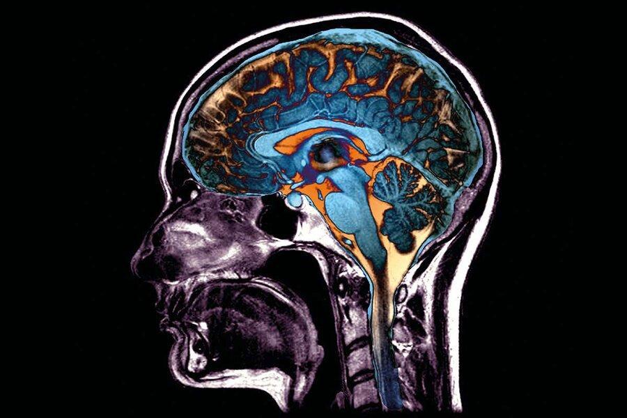 ویروس کرونا چه آسیب هایی به مغز می زند؟