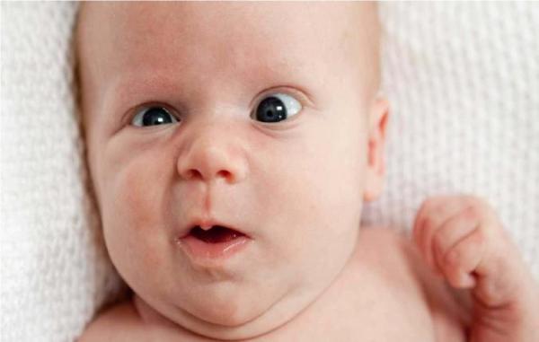 هرآنچه که باید راجع به انحراف چشم نوزاد بدانیم